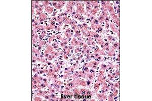 AL Antibody (Center) (ABIN657476 and ABIN2846504) immunohistochemistry analysis in formalin fixed and paraffin embedded human liver tissue followed by peroxidase conjugation of the secondary antibody and DAB staining. (PLAP antibody  (AA 282-309))