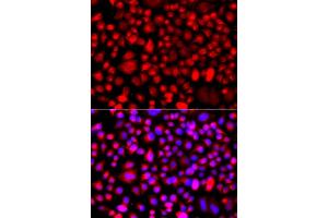 Immunofluorescence analysis of A549 cells using ALG1 antibody (ABIN5975731). (ALG1 antibody)