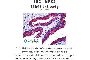 Image no. 1 for anti-Natriuretic Peptide Receptor B/guanylate Cyclase B (Atrionatriuretic Peptide Receptor B) (NPR2) (AA 131-231) antibody (ABIN1723733) (NPR2 antibody  (AA 131-231))