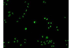 Immunofluorescence staining of Hela cells with ABIN7163739 at 1:100, counter-stained with DAPI. (PARP1 antibody  (AA 324-541))