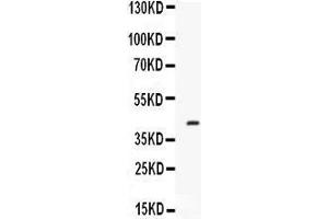 Western blot analysis of Factor D expression in mouse spleen extract (lane 1).