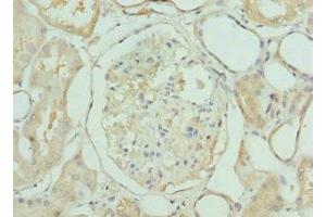 Immunohistochemistry of paraffin-embedded human kidney tissue using ABIN7158340 at dilution of 1:100 (LIMS1 antibody  (AA 1-325))
