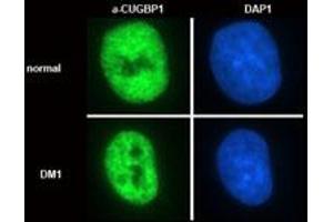 Detection of the subcellular distribution of CUGBP1 (nuclear, non-nucleolar) in normal and DM1 (dystrophia myotonica)  myoblasts using CUGBP1 monoclonal antibody, clone 3B1 .