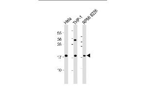 All lanes : Anti-GPX7 Antibody (Center) at 1:2000 dilution Lane 1: Hela whole cell lysate Lane 2: THP-1 whole cell lysate Lane 3: RI 8226 whole cell lysate Lysates/proteins at 20 μg per lane. (Glutathione Peroxidase 7 antibody  (AA 73-107))