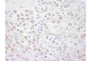Immunohistochemistry (IHC) image for anti-Polymerase (DNA Directed), lambda (POLL) (AA 525-575) antibody (ABIN7448731) (POLL antibody  (AA 525-575))