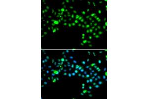 Immunofluorescence analysis of MCF-7 cells using SRSF4 antibody (ABIN5974197).