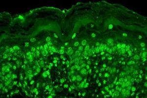 Immunohistochemistry analysis using Mouse Anti-Cav Beta2 Calcium Channel Monoclonal Antibody, Clone S8b-1 . (CACNB2 antibody  (AA 189-205) (PerCP))