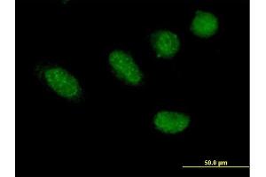 Immunofluorescence of purified MaxPab antibody to GRHL2 on HeLa cell. (GRHL2 antibody  (AA 1-625))