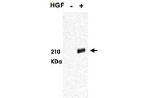 Western blot using MET (phospho Y1349/1356) polyclonal antibody  shows detection of phosphorylated MET. (c-MET antibody  (pTyr1349, pTyr1356))