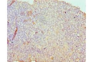 Immunohistochemistry of paraffin-embedded human tonsil tissue using ABIN7171193 at dilution of 1:100 (Syndecan 1 antibody  (AA 25-240))