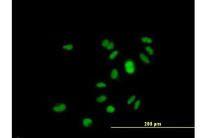 Immunofluorescence of purified MaxPab antibody to GINS1 on HeLa cell.