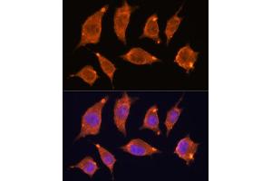 Immunofluorescence analysis of L929 cells using  antibody (ABIN7265407) at dilution of 1:100. (ATF5 antibody)