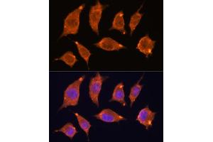 Immunofluorescence analysis of L929 cells using  antibody (ABIN7265407) at dilution of 1:100.