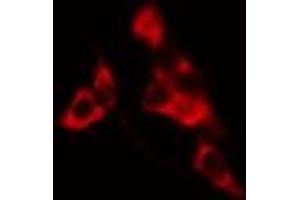 ABIN6275216 staining HuvEc cells by IF/ICC. (LSP1 antibody  (C-Term))