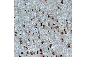 Immunohistochemical analysis of CACNG4 staining in rat brain formalin fixed paraffin embedded tissue section. (CACNG4 antibody)