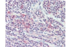 Human Small Intestine, MALT: Formalin-Fixed, Paraffin-Embedded (FFPE) (KLRC1 antibody  (AA 1-30))