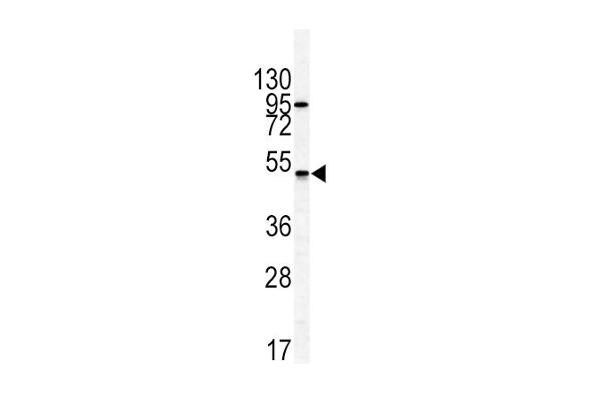 GIPR antibody  (N-Term)