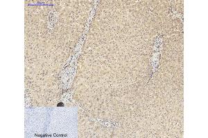 Immunohistochemical analysis of paraffin-embedded human liver tissue. (STS antibody  (AA 10-90))