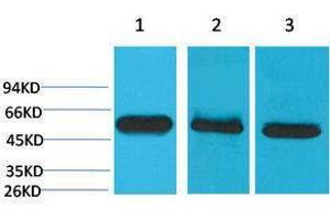 Western Blotting (WB) image for anti-Caspase 8 (CASP8) antibody (ABIN3181527) (Caspase 8 antibody)