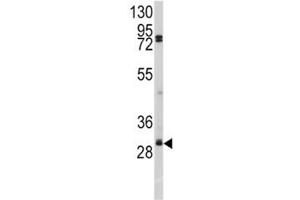 Western blot analysis of SLUG antibody and A2058 lysate. (SLUG antibody  (AA 1-30))
