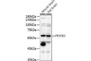 Western blot analysis of extracts of various cell lines, using PFKFB3 antibody (ABIN6129841, ABIN6145485, ABIN6145487 and ABIN6222692) at 1:500 dilution. (PFKFB3 antibody  (AA 400-500))