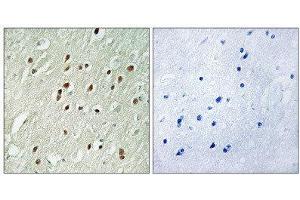 Immunohistochemistry (IHC) image for anti-Centrobin, Centrosomal BRCA2 Interacting Protein (CNTROB) (Internal Region) antibody (ABIN1851052)