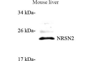 Western blot analysis of NRSN2 (ABIN7074806) at dilution of 1: 500 (NRSN2 antibody)