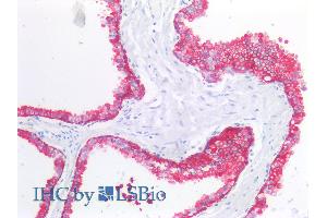 Immunohistochemistry (Paraffin-embedded Sections) (IHC (p)) image for anti-Keratin 19 (KRT19) antibody (ABIN94290)
