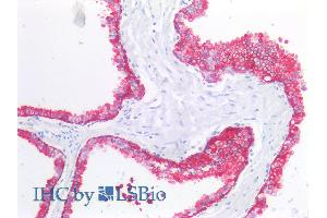 Immunohistochemistry staining of human prostate (paraffin sections) using anti-cytokeratin 19 (A53-B/A2). (Cytokeratin 19 antibody)