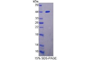 SDS-PAGE (SDS) image for Tryptophanyl tRNA Synthetase 2, Mitochondrial (WARS2) (AA 1-360) protein (His tag) (ABIN4990270)