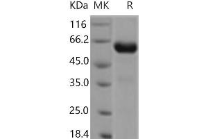 Western Blotting (WB) image for Chondrolectin (CHODL) protein (Fc Tag) (ABIN7321094) (CHODL Protein (Fc Tag))