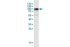 Western Blot detection against Immunogen (93. (WDR62 antibody  (AA 1-630))