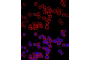 Immunofluorescence analysis of MCF7 cells using Caspase-1 Rabbit pAb (ABIN3021170, ABIN3021171, ABIN3021172 and ABIN6214049) at dilution of 1:150 (40x lens). (Caspase 1 antibody  (AA 1-311))