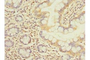 Immunohistochemistry of paraffin-embedded human small intestine tissue using ABIN7152386 at dilution of 1:100 (FCHSD2 antibody  (AA 1-290))
