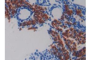 DAB staining on IHC-P; Samples: Mouse Ovary Tissue (Fibulin 5 antibody  (AA 170-243))