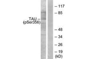Western blot analysis of extracts from 293 cells treated with serum 10% 15', using Tau (Phospho-Ser356) Antibody.
