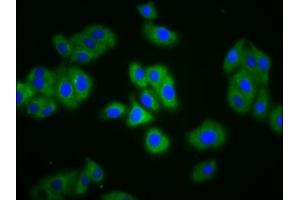 Immunofluorescence staining of HepG2 cells with ABIN7151491 at 1:133, counter-stained with DAPI. (NBC4 antibody  (AA 1071-1137))