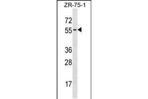 Western blot analysis in ZR-75-1 cell line lysates (35ug/lane). (TCN1 antibody  (C-Term))