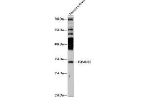 Western blot analysis of extracts of mouse spleen, using TSP antibody (ABIN7270785) at 1:3000 dilution.