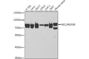 Western blot analysis of extracts of various cell lines, using HEC1/HEC1/NDC80 antibody (ABIN6131748, ABIN6144439, ABIN6144441 and ABIN6221060) at 1:1000 dilution. (NDC80 antibody  (AA 343-642))