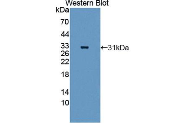 ANGPTL5 antibody  (AA 141-383)