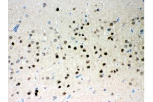 Anti- Parkin Picoband antibody, IHC(P) IHC(P): Rat Brain Tissue (Parkin antibody  (AA 23-416))