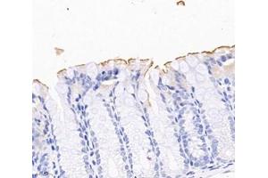Immunohistochemistry analysis of paraffin-embedded mouse colon using,PLS1 (ABIN7075096) at dilution of 1: 2000 (PLS1 antibody)