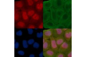 ABIN7095311 and ABIN7099368 staining Hela cells(30 min of UV treatment) by IF/ICC. (SOHLH2 antibody)