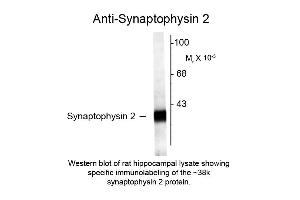 Western blot of Anti-Synaptophysin 2 (Rabbit) Antibody - 612-401-E36 Western Blot of Rabbit anti-Synaptophysin 2 antibody. (Synaptophysin 2 antibody  (C-Term))