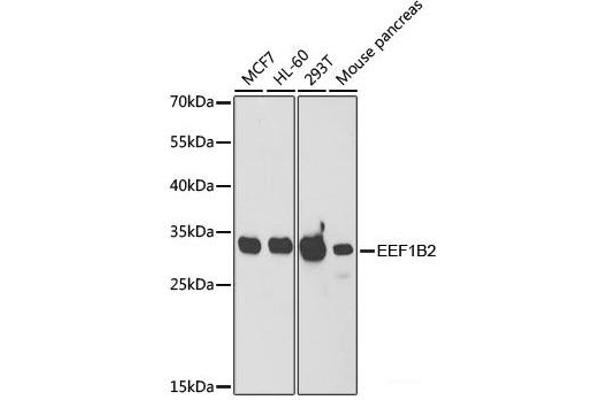 EEF1B2 Antikörper