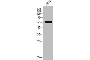 Western Blot analysis of 293T cells using CYP3A7 Polyclonal Antibody