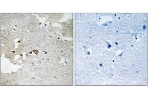 Immunohistochemistry analysis of paraffin-embedded human brain, using AXL (Phospho-Tyr691) Antibody. (AXL antibody  (pTyr691))