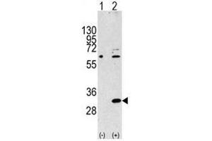 Image no. 2 for anti-Eukaryotic Translation Initiation Factor 4E Family Member 2 (EIF4E2) (N-Term) antibody (ABIN357298) (EIF4E2 antibody  (N-Term))