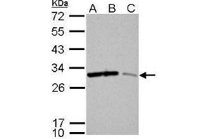 WB Image 14-3-3 sigma antibody detects SFN protein by Western blot analysis.
